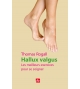 Hallux valgus