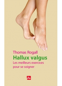 Hallux valgus